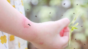No More Biting! Defending Your Home Against Mosquitos & Pests in Rainy Season!